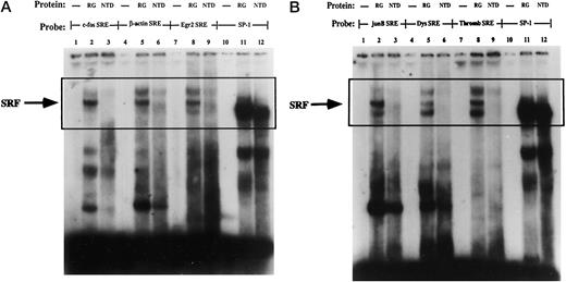 Fig. 4. Repression of the SRF DNA binding activity to multiple SREs in differentiated 3T3T cells. SRF DNA binding activity of nuclear extracts prepared from either growing 3T3T cells (A and B, Lanes 2, 5, 8, and 11) or differentiated 3T3T adipocytes (A and B, Lanes 3, 6, 9, and 12) and 0.035 pmol of 32P end-labeled oligonucleotides is presented. More specifically, A is c-fos SRE (Lanes 1–3), β-actin SRE (Lanes 4–6), EGR2 SRE (Lanes 7–9), and a single SP-1 binding site (Lanes 10–12); B is junB SRE (Lanes 1–3), dystrophin SRE (Lanes 4–6), thrombospondin-1 SRE (Lanes 7–9), or a single SP-1 binding site (Lanes 10–12). Lanes 1, 4, 7, and 10 in A and B contain the DNA probes without nuclear proteins. The arrow indicates the major SRF-SRE complex that is present within the boxed area. RG, rapidly growing cells; NTD, NTD cells.