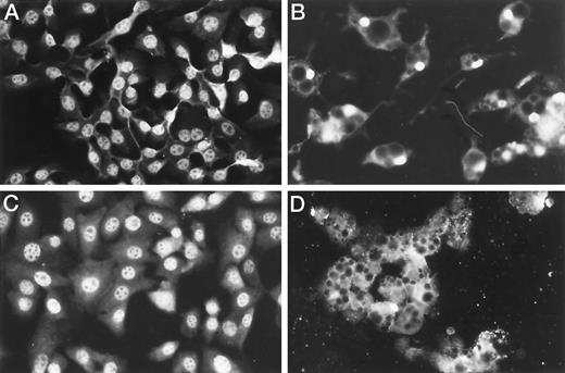 Fig. 8. Decreased nuclear localization of SRF in differentiated cells demonstrated by indirect immunofluorescence microscopy. The localization of SRF and SP-1 in growing undifferentiated 3T3T cells and in differentiated 3T3T adipocytes was evaluated using rabbit anti-SRF or anti-SP-1 antibodies and fluorescence-labeled secondary antibodies. As determined by immunofluorescence microscopy, the nuclear localization of SP-1 can be clearly detected in undifferentiated growing 3T3T cells (A) and in differentiated 3T3T adipocytes (B). In contrast, SRF shows a strong nuclear localization in undifferentiated 3T3T cells (C), but minimal nuclear localization in differentiated 3T3T adipocytes (D). Due to significant background staining with the anti-SRF antibody in 3T3T adipocytes that contain numerous fat droplets, the repression of SRF nuclear localization is difficult to illustrate, but it is easily documented using biochemical methods (see Fig. 9<$REFLINK>).