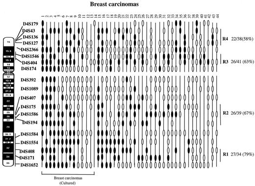 Fig. 1. Patterns of LOH in breast carcinomas, exhibiting deletions of 4q and 4p. The cases have been arranged from left to right in decreasing order of chromosome 4 deletions (cases 1–14 and cases 15–44). Cases 1–14 represent breast carcinomas from which the cell lines were derived. Markers are placed in the predicted order from 4pter-qter. Regions (R1–R4) showing frequent allelic losses are identified by bars at the right. Closed ellipses, allelic loss; open ellipses, retention of heterozygosity; line, noninformative.