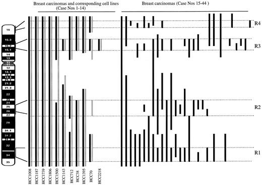 Fig. 2. Diagrammatic representation of chromosome 4 deletions in breast cell lines, their corresponding cultured breast carcinomas, and sporadic breast carcinomas. The cases are arranged in decreasing order of the extent of chromosome 4 deletions (as described in the Fig. 1<$REFLINK> legend). The comparison of the deletions in cultured breast carcinomas and the corresponding cell lines is shown in the left portion of the figure. The hollowgram bars on the right represent breast carcinoma cell lines, whereas the solid bars on the left represent the corresponding breast carcinomas from which the cell lines were derived. The cell line numbers are shown at the bottom. The deletions in noncultured breast carcinomas (solid bars) are shown in the right portion of the figure. The dotted lines represent minimal regions of deletions. Differences in lengths and positions of bars within a region of minimal deletions are based on the number of markers in that region and the orientation (telomeric or centromeric) of deletions. Three cell lines (HCC1685, HCC1569, and HCC2157) and their corresponding breast carcinomas (cases 12–14 in Fig. 1<$REFLINK>) and one noncultured breast carcinoma (case 44 in Fig. 1<$REFLINK>) did not show LOH at any of the informative markers; therefore, they are not shown in Fig. 3<$REFLINK>.