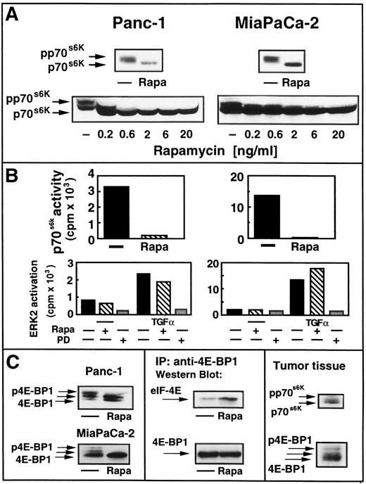 Fig. 1. Constitutive phosphorylation/activation of p70s6K and 4E-BP1 in Panc-1 and MiaPaCa-2 cells. A, top panels, serum-starved cultures of Panc-1 (left) and MiaPaCa-2 cells (right) were treated with 20 ng/ml rapamycin (Rapa) or received an equivalent amount of solvent (—). p70s6K mobility shift assays were performed as described in “Materials and Methods.” The results shown in each case are representative of three independent experiments. The positions of hypophosphorylated p70s6K (p70s6K) and the slower-migrating phosphorylated p70s6K (pp70s6K) are indicated by arrows. Bottom panels, serum-starved cultures of Panc-1 (left) and MiaPaCa-2 cells (right) were treated with various concentrations of rapamycin as indicated for 20 min or received an equivalent amount of solvent (—). p70s6K mobility shift assays were performed as described in “Materials and Methods.” The results shown in each case are representative of three independent experiments. The positions of hypophosphorylated p70s6K (p70s6K) and the slower-migrating phosphorylated p70s6K (pp70s6K) are indicated by arrows. B, top panels, serum-starved cultures of Panc-1 (left) and MiaPaCa-2 cells (right) were treated with 20 ng/ml rapamycin for 20 min (Rapa) or received an equivalent amount of solvent (—). Cells were subsequently lysed, and immune complex kinase assays for p70s6K activity were performed as described in “Materials and Methods.” Bottom panels, serum-starved cultures of Panc-1 (left) and MiaPaCa-2 cells (right) were treated with 20 ng/ml rapamycin (Rapa +) for 20 min or 20 μm PD 098059 (PD +) for 40 min or received an equivalent amount of solvent (—). Cells were then incubated with 50 ng/ml TGF-α for 5 min (TGF-α +) and lysed, and immune complex kinase assays for ERK2 activity were performed as described in “Materials and Methods.” C, left panels, serum-starved cultures of Panc-1 (top) and MiaPaCa-2 cells (bottom) were treated with 20 ng/ml rapamycin (Rapa) as indicated for 20 min. Control cells received an equivalent amount of solvent (—). 4E-BP1 mobility shift assays were performed as described in “Materials and Methods.” The results shown in each case are representative of three independent experiments. The positions of hypophosphorylated 4E-BP1 (4E-BP1) and the slower-migrating phosphorylated forms of 4E-BP1 (p4E-BP1) are indicated by arrows. Middle panels, cells were treated as described above and lysed, and lysates were immunoprecipitated using a specific anti-4E-BP1 antibody as described in “Materials and Methods.” Western blotting was performed using an anti-eIF-4E antibody (top) or an anti-4E-BP1 antibody (bottom) as described in “Materials and Methods.” Right panels, human pancreatic cancer tissue samples were lysed and subsequently analyzed by SDS-PAGE with an anti-p70s6K (top) or an anti-4E-BP1 antibody (bottom) as described in “Materials and Methods.” The positions of hypophosphorylated and hyperphosphorylated p70s6K (p70s6K and pp70s6K) and 4E-BP1 (4E-BP1 and p4E-BP1) are indicated by arrows.