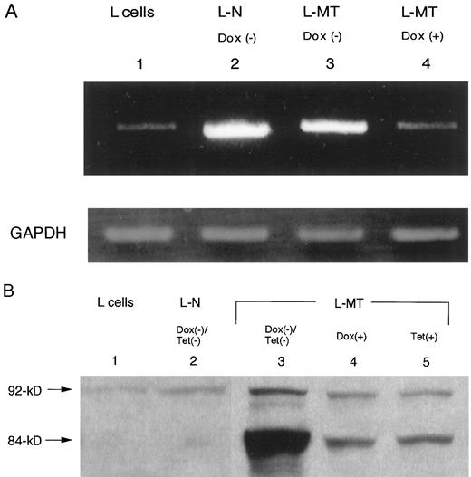 Fig. 1. A, RT-PCR analysis for β-catenin and GAPDH expression in parental L cells and l-N cells without doxycycline and in l-MT cells with or without doxycycline. β-catenin was most strongly expressed in l-N and l-MT [Dox(−)] cells. B, Western blot analysis of L, l-N, and l-MT cells with or without tetracycline or doxycycline. Accumulation of exogenous β-catenin (Mr 84,000) in l-MT cells was suppressed in the presence of either doxycycline or tetracycline.