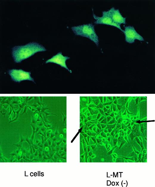 Fig. 2. A, immunofluorescence analysis of l-MT cells cultured without doxycycline using anti-β-catenin antibody. Strong staining in the cytoplasm and nucleus is apparent. B, morphological changes observed in l-MT cells cultured without doxycycline, in comparison to the parental L cells. Arrows, heightened cell-cell contacts.