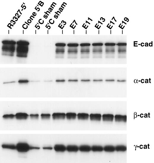 Fig. 1. Western blot analysis of E-cadherin/catenin after the transfection of E-cadherin cDNA into clone 5′C cells. The R3327-5′ clones and sham-transfected cells were used as controls. E-cadherin transfection significantly up-regulated the levels of the three major catenins. 5′C sham, sham-transfected clone 5′C; E3–E19, stable E-cadherin transfectants of clone 5′C.