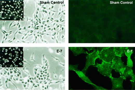 Fig. 2. E-cadherin transfection induces morphological changes and cellular cohesion. The transfected cells (E-7, bottom left panel) tend to adhere to each other and form compact, epithelial-like clusters, whereas sham-transfected cells (sham control; top left panel) exhibit a dispersed fibroblastic phenotype. Increased Ca2+-dependent cellular cohesion was observed in the transfectants (E-7; bottom left panel, inset) when compared with the sham control (top left panel, inset). Immunofluorescence staining demonstrates the expression of E-cadherin in the intercellular contacts between transfected cells (E-7; bottom right panel). No staining was found in the sham control cells, even when the cells were confluent (top right panel).