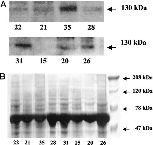 Fig. 1. A, IGF-1R protein was analyzed by Western blot, using an antibody against the α-subunit of IGF-1R. The same amount of total protein was loaded for all samples. B, protein samples were stained with Coomassie Brilliant Blue. The same amount of total protein was loaded on the gel.