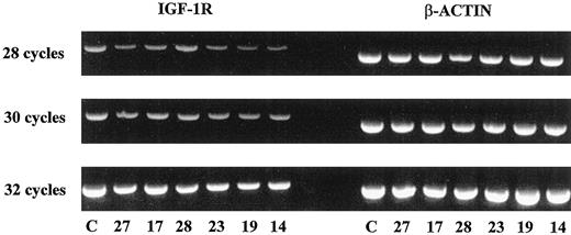 Fig. 2. IGF-1R gene expression in six samples and the control cell line. Total mRNA were reverse-transcribed and then amplified with IGF-1R and β-actin primers for 28, 30, and 32 cycles.