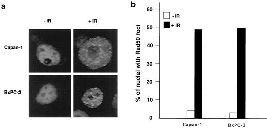 Fig. 2. Rad50 foci formation in Capan-1 and BxPC-3 cells without IR treatment and 2 h after treatment with 10 Gy of IR. a, immunostaining of Rad50 foci. b, histogram shows the percentages of cells with Rad50 foci. At least 200 cells were scored for each data point.