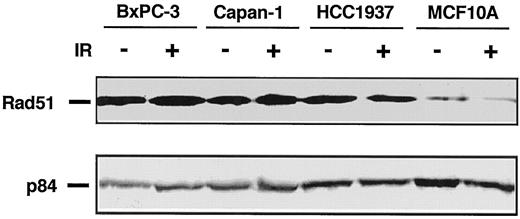 Fig. 3. Rad51 protein expression in cells without IR treatment and 2 h after 10 Gy of IR treatment. Extracts of the cells were subjected to immunoblotting with antibodies against Rad51 and p84.