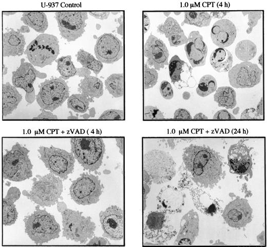 Fig. 2. The effects of caspase inhibition on cellular morphology in CPT-treated U-937 cells. Electron micrographs of control and CPT-treated U-937 cells in the absence or presence of zVAD-fmk. Cells were collected and processed for electron microscopy at the indicated times after drug treatment.