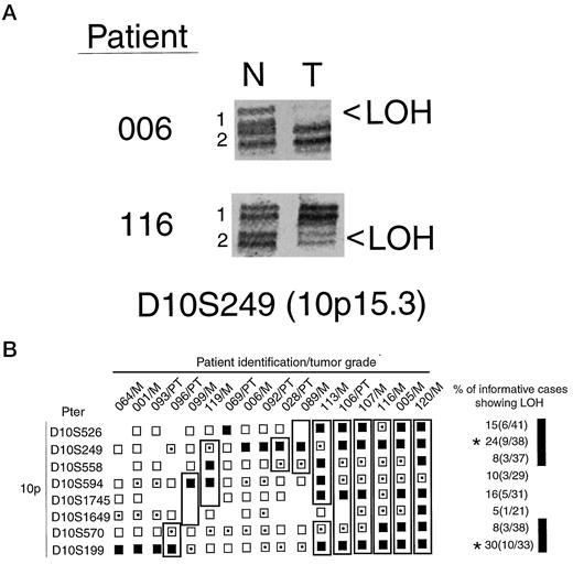 Fig. 1. LOH defines two putative melanoma suppressor regions on 10p. A, examples of LOH at marker D10S249 (10p15.3) are shown for two tumor samples (006 and 116). Normal tissue (N) is shown along side tumor material (T) for each patient. Numbers 1 or 2 show the locations of each allele, and arrows point to the allele where loss is evident. B, LOH on the short arm of chromosome 10 in 17 melanoma tumor samples. Alleles are designated as: heterozygous with loss (▪); heterozygous with no loss (□); and constitutionally homozygous (). A combination of both metastatic (M) and primary tumors (PT) were studied. Areas showing loss in each tumor are outlined, and common areas of loss are indicated by a solid line.