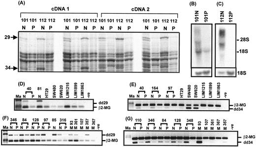 Fig. 1. A, autoradiograph of a differential display gel showing amplified products from RNA isolated from matched normal colon (N) and primary colorectal tumor (P) tissues. Arrows, differentially expressed bands dd29 (MUC12) and dd34 (MUC11). B, Northern blot analysis of total RNA from patient 101 hybridized with the dd29 probe. C, Northern blot analysis of RNA from patient 112 hybridized with the dd34 probe. Signal corresponding to 18S rRNA is shown as a loading control. D, multiplex, semiquantitative RT-PCR showing amplification of dd29 mRNA transcripts from matched normal colonic mucosa and primary tumor no. 40, normal mucosa from patient 81, and six colorectal cancer cell lines. E, multiplex, semiquantitative RT-PCR showing dd34 mRNA transcripts in matched normal colonic mucosa and primary tumors of patients 40, 164, and 97 and six colorectal cancer cell lines. Amplification of β2-microglobulin (β2-MG) is included as a measure of total RNA. F, multiplex semiquantitative RT-PCR showing amplification of dd29 mRNA transcripts from matched normal colonic mucosa and primary tumors 346, 84, 128, 97, and 316 and from five unpaired Dukes’ stage D tumors (M) 93, 361, 107, 357, and 367. G, multiplex semiquantitative RT-PCR showing dd34 mRNA transcripts in matched normal colonic mucosa and primary tumors of patients 110, 346, 84, 128, and 348 and from five unpaired Dukes’ stage D tumors (M) 93, 107, 361, 367, and 357. Ma, molecular size markers.