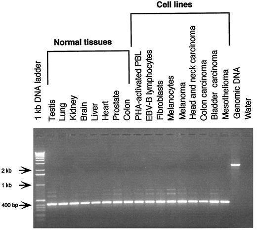 Fig. 3. RT-PCR analysis of MAGE-D expression. Total RNA from the indicated normal tissue samples or cultured cell lines were submitted to 30 cycles of RT-PCR amplification with MAGE-D-specific primers. The products were analyzed by agarose gel electrophoresis. Samples of normal stomach, adrenal gland, skin, breast, and uterus (not shown in the figure) were also positive.