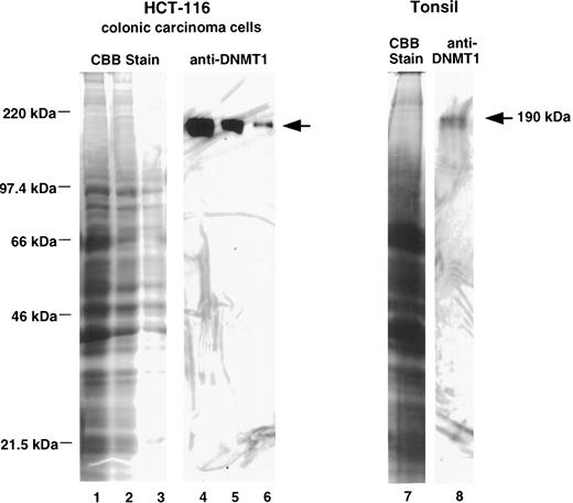 Fig. 1. Immunoblot analysis of protein extracts from HCT-116 colonic carcinoma cells and from human tonsil tissue for DNMT1 expression using anti-DNMT1 antibodies. Protein extracts were electrophoresed on polyacrylamide gels in the presence of SDS and stained with Coomassie brilliant blue (CBB) or transferred to nitrocellulose filters and stained with anti-DNMT1 antibodies (anti-DNMT1) as described in “Materials and Methods.” Lanes 1 and 4, 400 μg of HCT-116 protein extract; Lanes 2 and 5, 200 μg of HCT-116 protein extract; Lanes 3 and 6, 100 μg of HCT-116 protein extract; Lanes 7 and 8, 2 mg of tonsil protein extract. A single polypeptide of Mr ≈190,000 was detected in each extract.