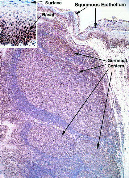 Fig. 2. Immunohistochemical staining for DNMT1 in human tonsil tissue. Lymphoid cells in germinal centers and basal epithelial cells in respiratory epithelium expressed significant levels of DNMT1. Similar staining patterns were observed using antibodies directed against PCNA, Ki-67, and topoisomerase IIα.