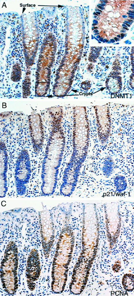 Fig. 3. Immunohistochemical staining for DNMT1, PCNA, and p21 in normal colonic epithelium. Crypt cells expressed DNMT1 and PCNA but not p21; surface cells expressed p21 but not DNMT1 and PCNA.