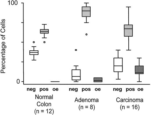 Fig. 6. Progressive dysregulation of DNMT1 expression during colorectal carcinogenesis. Using tissue sections stained with anti-DNMT1 antibodies, the fractions of epithelial cells not expressing DNMT1 (neg), expressing physiological levels of DNMT1 (levels present in normal colonic crypt cells; pos), or expressing very high DNMT1 levels (greater than present in normal colonic crypt cells; overexpressed or oe) were estimated for normal colonic epithelium (Normal Colon; n = 12), for colonic adenomas (Adenoma; n = 8), and for colonic carcinomas (Carcinoma; n = 16). The percentage of cells at each DNMT1 expression level for each group is displayed. Central bars within boxes, median percentages. Upper bars of the boxes, upper quartile; lower bars of the boxes, lower quartile. Bars above and below boxes, 95% confidence limits. ○, outlier cases. Statistical analyses were accomplished using STATA 5.0 software for Windows 95. For the appearance of cells expressing high levels of DNMT1 (oe), a trend of increasing numbers of such cells associated with the progression from normal colonic epithelium to colonic adenoma to colonic carcinoma (estimated as the Pearson product-moment correlation coefficient, r, of 0.729 with P < 0.0001), was detected.