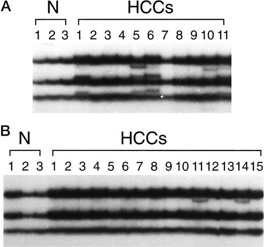 Fig. 1. SSCP analysis of β-catenin in HCCs induced by DEN (A) and the CDAA diet (B). Abnormal bandshifts are apparent in for HCC1, HCC5, HCC6, HCC10, and HCC11 (A) and in HCC11 and HCC14 (B). Lanes N, normal liver.