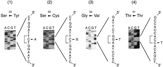 Fig. 2. Sequence analysis of β-catenin in HCCs demonstrating abnormalities in codons 33, 34, and 41. These results and the corresponding sample numbers are summarized in Table 1<$REFLINK>.