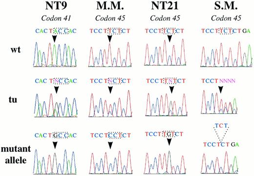 Fig. 1. Nucleotide sequences of β-catenin mutations in four WT specimens. Electropherograms for the regions comprising codon 41 (NT9) and codon 45 (M.M., NT21, and S.M.) showing wild-type (wt) sequences derived from control samples (top), sequences derived from direct sequencing of tumor (tu)-derived PCR fragments (middle), and sequences of isolated mutant alleles as obtained after subcloning (bottom). The affected codons are boxed, and the affected nucleotides are indicated by an arrow.