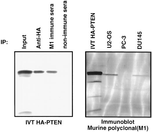 Fig. 1. Immunoprecipitation of in vitro translated HA-PTEN with the murine polyclonal antisera M1. HA-PTEN was produced by in vitro translation and immunoprecipitated with either anti-HA antibody, murine polyclonal antisera M1, or nonimmune murine antisera, as indicated (left panel). The input is 5 μl of in vitro translated HA-PTEN loaded in sample buffer. Immunoblot detection of endogenous PTEN was performed using murine polyclonal antisera M1.Whole cell extracts (150 μg) prepared from U2-OS cells, PC-3 cells, and DU145 cells (as indicated) and HA-PTEN produced by in vitro translation were separated by gel electrophoresis, transferred to polyvinylidene difluoride membrane, and immunoblotted with murine polyclonal antisera M1 (right panel).