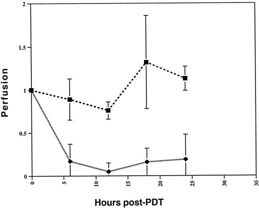 Fig. 4. Flow measurements using laser-Doppler in control [dextrose, light at 150 J/cm2(▪)] and PDT-treated tumors(♦). Flow measurements were made before treatment and at 6, 12, 18, and 24 h after treatment. Compared with the control tumors, PDT-treated tumors showed decreased flow by 6 h that persisted even at 24 h after treatment. Bars, SE.