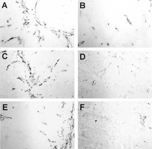 Fig. 6. Photomicrographs of control (left panels) and PDT-treated (right panels) cryopreserved tumor sections immunostained for blood vessels using an anti-PECAM antibody. Tissue sections of control tumors at 4, 18, and 36 h (A, C, and E, respectively) show normal blood vessels, whereas the PDT-treated tumors at 4, 18, and 36 h after treatment (B, D, and F, respectively) show a progressive disruption of the endothelial layer of blood vessels. ×100.