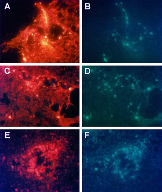 Fig. 8. Photomicrographs of double-labeled control and PDT-treated tumor tissue sections for blood vessels (left panels) and apoptosis (right panels). Tissue sections were immunofluorescently labeled for blood vessels using a rat anti-mouse PECAM antibody and anti-rat IgG Texas red and later labeled for apoptosis using the TUNEL assay. The double-labeled sections show that at the early time points, 4 h (A and B), 8 h (C and D), and 12 h (E and F) after PDT, apoptotic cells first appear around blood vessels.
