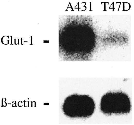 Fig. 1. Northern blot analysis of Glut-1 expression. A431 cells show higher Glut-1 mRNA levels than do T47D cells. The same blot was hybridized with a β-actin probe as control.