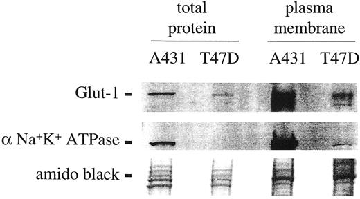 Fig. 2. Western blot analysis of total and plasma membrane-enriched fractions of A431 and T47D cells. Total and plasma membrane Glut-1 levels are higher in A431 extracts than in T47D extracts. The plasma membrane marker, α1 subunit of the human Na+K+-ATPase, is enriched in the plasma membrane fractions of both cell lines. Comparable amounts of total protein are loaded in each lane, as shown by amido black staining of the blot.