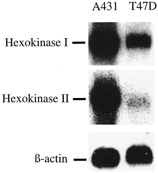 Fig. 7. Northern blot analysis for hexokinase I and II mRNA. A431 cells have higher mRNA levels for both hexokinase subtypes.