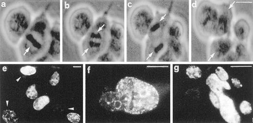 Fig. 2. Fate of human carcinoma cells after release from Taxol. a–d, consecutive video captures showing a cell that undergoes mitosis 5 h after release from Taxol (phase contrast micrographs). Arrows (a–d), the metaphase plate, chromosome packages, and daughter cell nuclei. e–g, incorporation of BrdUrd in cells treated with Taxol and released for 24 h into normal medium. BrdUrd has been traced using anti-BrdUrd antibodies and indirect immunofluorescence microscopy. Arrowheads (e), cells that have incorporated various amounts of the base analogue into the DNA, having progressed to a different extent through the cell cycle. As can be seen in f and g, lobulated nuclei and micronuclei incorporate BrdUrd similarly to the oval-shaped nuclei shown in e. Scale bars, 5 μm.