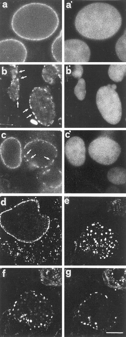 Fig. 3. Aberrant distribution of the NPCs. a and a′, nontreated cells. b–g, b′, and c′, cells treated with Taxol and cultured for 24 h into normal medium. The specimens have been stained with antinucleoporin antibodies (a–g) and DAPI (a′–c′). a–c and a′–c′, conventional epifluorescence pictures; d–g, confocal images. Arrows (b and c), large NPC clusters which contrast the continuous, rim-fluorescence pattern seen in a. The micrograph in d shows ectopically localized NPCs that have accumulated in the cytoplasm. e–g, consecutive optical sections of the same cell, illustrating the distribution of NPC clusters on the surface of the nucleus. Scale bar, 5 μm.