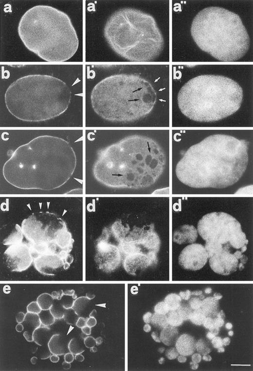 Fig. 4. Nuclear lamina defects. a, a′, and a′′, nontreated cells. b–e, b′–e′, and b′′-d′′, cells treated with Taxol and cultured for 24 h into normal medium. The specimens were stained with anti-lamin B antibodies (a–e and a′–d′) and DAPI (a′′–d′′ and e′). Conventional epifluorescence pictures taken at different focal levels are shown in a–d and a′–d′ to better visualize nuclear lamina damage. Note the interruptions of the normal rim-fluorescence pattern and the moth-eaten appearance of the structure (arrowheads and arrows). Scale bar, 3 μm.