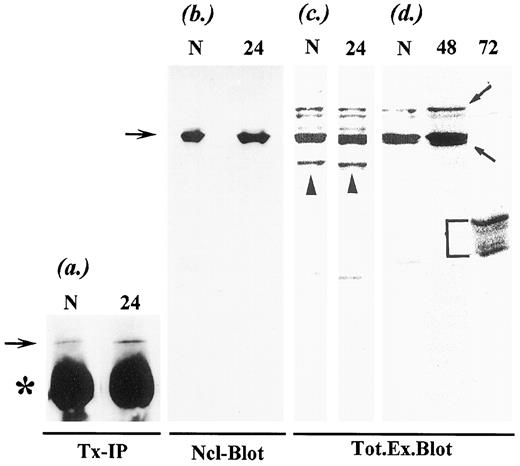 Fig. 6. Apoptotic degradation of B-type lamins. a, detergent/high-salt extracts of control (Lane N) and Taxol-treated cells released for 24 h (Lane 24) were precipitated by anti-lamin B antibodies. The immunoprecipitates have been resolved by SDS-PAGE and probed with the same antibodies. b–d, Western blotting analysis of nuclear extracts (b) and total cell lysates (c and d) from control (Lanes N) and Taxol-treated cells released for 24 (Lanes 24), 48 (Lane 48), and 72 (Lane 72) h. The profiles shown represent three separate Western blotting experiments. Blots in a and b were developed by alkaline phosphatase-conjugated secondary antibodies, whereas those in c and d have been developed by ECL. Both B1 (Mr 68,000) and B2 (Mr 74,000) lamins are detected by the more sensitive chemiluminescence technique, whereas only the major lamin B1 band is visible by color. Arrows, position of unproteolysed lamins; bracket, major degradation products generated by apoptotic cleavage; arrowheads, minor degradation fragments that arise from in vitro proteolysis during sample processing; *, heavy chain of IgG. Tx-IP, immunoprecipitation from Triton X-100/high-salt extract; Ncl-Blot, Western blot on isolated nuclei; Tot.Ex.Blot, Western blot on total cellular extract.