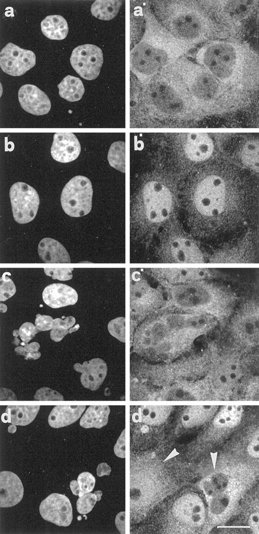Fig. 8. Nuclear translocation of NFκB. a and a′, nontreated cells before stimulation with TNF-α; b and b′, nontreated cells after stimulation with TNF-α; c and c′, Taxol-treated cells released for 24 h before stimulation with TNF-α; and d and d′, Taxol-treated cells released for 24 h after stimulation with TNF-α. For details, see text. a–d, location of NFκB65 subunit; a′–d′, DAPI staining. All images were obtained using a confocal microscope. Arrowheads, cells that have failed to import NFκB in a normal fashion. Scale bar, 10 μm.