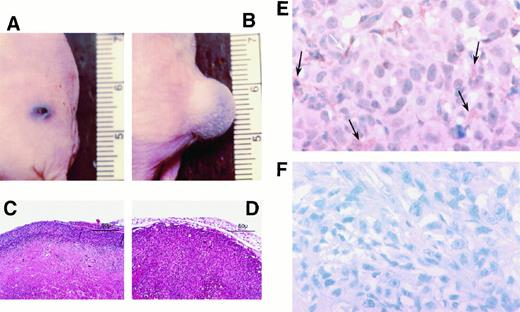 Fig. 4. ffects of TNF-α in previously TNF-resistant Pmel melanoma. A, macroscopic tumor regression and necrosis 14 days after systemic administration of vvEMAP. B, normal tumor growth observed after TNF treatment of animals pretreated with the control vector vvLuc. C, subtotal tumor necrosis, sparing only a small rim of viable tumor cells (magnification, 10×). D, nonnecrotic viable tumor in control animals. E, immunohistochemistry using anti-EMAP-II antibody demonstrates the presence of protein in vvEMAP-pretreated tumors. Black arrows, scattered staining in a predominantly membrane-bound and cytoplasmic pattern. White arrows, nonspecific melanin granula, which are also present in tumors from control animals (F).