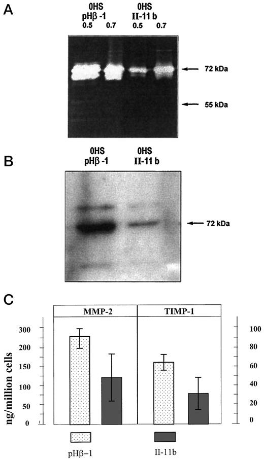 Fig. 2. Gelatin zymogram (A) and Western blotting (B) of harvested media from the two cell clones pHβ-1 and II-11b performed as described in “Materials and Methods.” C, levels of MMP-2 and TIMP-1 immunoactivity in pHβ-1 and II-11b cells. Subconfluent cells were cultured in serum free medium for 2 days, and conditioned media were collected and assayed by ELISA. Levels of immunoreactive MMP-2 and TIMP-1 are presented as mean of six and four independent determinations, respectively. Bars indicate 95% confidence interval for each sample.