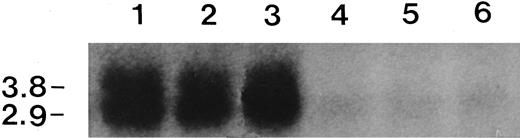 Fig. 6. Expression of FATP mRNA in hepatoma 7288CTC. Northern blot analysis showing levels of FATP mRNAs expressed by hepatoma 7288CTC (Lanes 1–3) and liver (Lanes 4–6). Total cellular RNA was extracted from rats maintained for 4 weeks on a 12L:12D cycle. Neither constant light exposure nor treatment with daily afternoon melatonin injections (200 μg) had any effect on expression of FATP mRNA (data not shown).