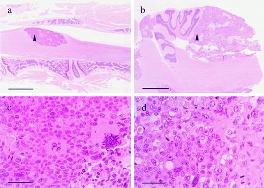 Fig. 1. Growth of MA-11 cells in CNS. MA-11 cells were injected into the LV (a and c) or the CM (b and d) of immunodeficient rats, which were sacrificed upon development of neurological symptoms (after ∼40 and ∼25 days, respectively). a and b, sections (scale bars, 2.0 mm) of the sacral spine and spinal cord from a rat injected LV and of infratentorial CNS structures (cerebellum and brain stem) from a rat injected CM, respectively. c and d, higher magnification (scale bars, 50 μm) of representative regions of the tumors (indicated by arrowheads in a and b, respectively).