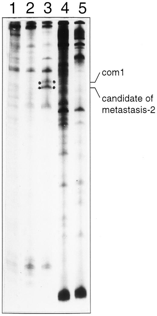 Fig. 2. Differential display analysis of MA-11 cell populations. Candidate PCR fragments (com1 and candidate of metastasis-2) are indicated. Lane 1, cell culture population (representing micrometastatic cells in bone marrow); Lane 2, CM population (cells isolated from meningeal tumors); Lane 3, LV population (cells isolated from spinal cord metastases); Lane 4, rat meninges (negative selection control for the CM population); Lane 5, rat spinal cord (negative selection control for the LV population). Primers used were 5′ -T11VA-3′ and AP2 (5′-GAAACGGGAC-3′). Candidate of metastasis-2 turned out to represent a false positive fragment.