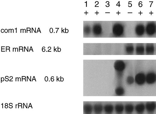 Fig. 6. Expression of com1 mRNA in breast cancer cell lines. Cell lines shown to be experimentally metastatic (+) or not (−) were analyzed by Northern blot hybridization. Lane 1, MA-11; Lane 2, MT-1; Lane 3, MDA-MB-231; Lane 4, MDA-MB-435; Lane 5, MCF-7; Lane 6, MCF7/LCC1; and Lane 7, MCF7/LCC2. Expression of mRNAs for ER and pS2 was measured as phenotypic controls. The 18S rRNA was estimated as an assay control.
