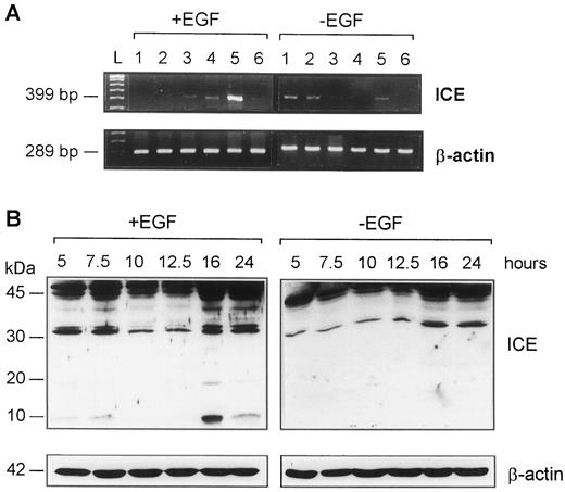 Fig. 1. Expression of ICE in human pancreatic carcinoma cell line AsPC-1. A, expression of ICE mRNA in EGF-stimulated and unstimulated cells after 5 (1), 7.5 (2), 10 (3), 12.5 (4), 16 (5), and 24 (6) h. Equal loading was confirmed by β-actin mRNA analysis. L, 100-bp DNA ladder. B, Western blot analysis of ICE expression in EGF-stimulated and -unstimulated cells after different times of incubation with EFG (25 ng/ml). Equal loading was confirmed by β-actin.