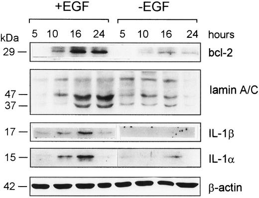 Fig. 2. Western blot analysis of the expression of bcl-2, IL-1α, IL-1β and of the fragmentation of lamin after different times of incubation with or without EGF (25 ng/ml). Bcl-2, IL-1α, and IL-1β were induced by EGF. Proteolysis of lamin into Mr 47,000 and 37,000 fragments occur after 16–24 h of EGF stimulation. Equal loading was confirmed by β-actin.