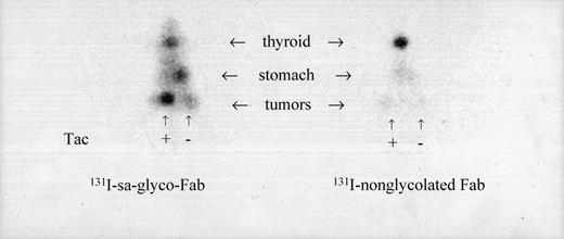 Fig. 8. Scintigraphy of nude mice injected with 131I-labeled sa-glyco-Fab (A) and 131I-labeled nonglycolated Fab (B) coinjected with lysine. Images were obtained 16 h after injection. The ATAC4 (Tac +) tumor is clearly shown on the image (A) and confirmed by rescanning after removal (data not shown). Image with 131I-labeled nonglycolated Fab (B) shows poor uptake in both specific and nonspecific tumors. The thyroid was not blocked with iodine.
