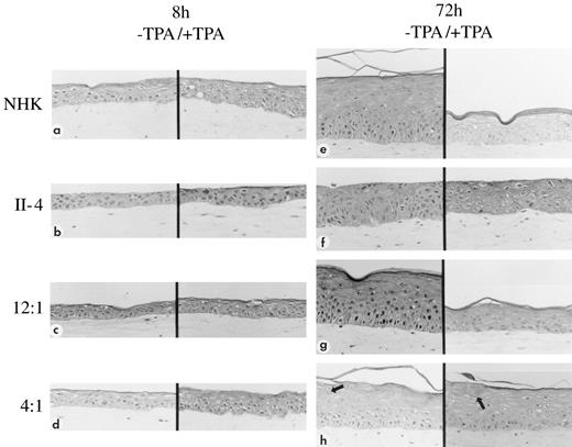 Fig. 6. The effects of TPA on the morphology of normal keratinocyte, II-4, 12:1 and 4:1 mixed cultures grow in the presence of TPA for either 8 or 72 h in organotypic culture. A comparison of organotypic cultures grown with and without TPA at 8 h (a–d) and at 72 h (e–h) demonstrates a decreased thickness and absence of Stratum granulosum for NHK and 12:1 mixtures when cultures are exposed to TPA for 72 h (e and g). TPA induced only mild alterations in pure II-4 and 4:1 mixtures. Clusters of II-4 cells demonstrating an altered morphology are seen in 4:1 mixtures (h). Pure cultures of NHK show complete morphological differentiation at 72 h (e), whereas II-4 cultures are dysplastic and show no morphological differentiation (f). TPA has induced little change in epithelial morphology or thickness at the 8-h time point (a–d).