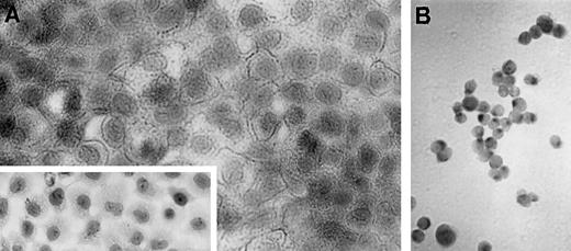 Fig. 3. Immunocytochemical staining of PCI-13 monolayers for expression of FasL with C-20 polyclonal Ab, which decorates cell surfaces of tumor cells (A). Inset, isotype control. A, ×600 (inset, ×300). FasL is localized to the Golgi in tumor cells transduced with the FasLgene and secreting FasL (B). B, ×100.