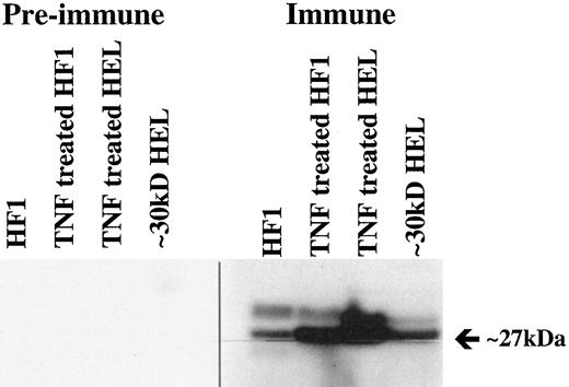 Fig. 10. Antibodies to TIP-B1 react with an ∼27 kDa protein in 100,000 × g supernatants from HF1 and HEL cells. Duplicate samples of 5 μg of cytosolic protein (100,000 × g supernatant) from several sources were separated by SDS-PAGE (12.5% gel) and electrotransferred to polyvinylidene difluoride membranes. The blot was blocked, hybridized with serum obtained prior to inoculation with TIP-B1 (Pre-immune, left panel) or anti-TIP-B1 antiserum (1:1000; Immune, right panel), hybridized with the secondary antibody (alkaline phosphatase-conjugated goat anti-rabbit IgG), and reacted with chemiluminescent substrate prior to visualization on film. Cytosolic protein samples were obtained from: untreated HF1 cells (Lane 1), TNF-treated (1000 units/ml; 24 h) HF1 cells (Lane 2), TNF-treated (1000 units/ml; 18 h) HEL cells (Lane 3), and a fraction enriched for TIP-B1 from HEL cells (Lane 4).