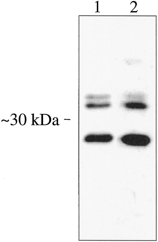 Fig. 11. Anti-TIP-B1 antiserum and anti-rTIP-B1p antiserum have similar reactivities. Western blot analysis was performed with protein extracted from HEL cells. Two primary antisera were used: antiserum against TIP-B1 (Lane 1) and antiserum against rTIP-B1p (Lane 2).
