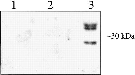 Fig. 12. Anti-TIP-B1 antiserum does not react with GSTπ. Western blot analysis was performed with anti-TIP-B1 primary antiserum. Protein samples were: GSTπ purified from placenta which resolves as a single band of ∼27 kDa on SDS-PAGE (Lane 1), HeLa cell extract provided as a positive control with an anti-GSTπ antibody (Lane 2), and partially purified TIP-B1 from HEL cells (Lane 3).